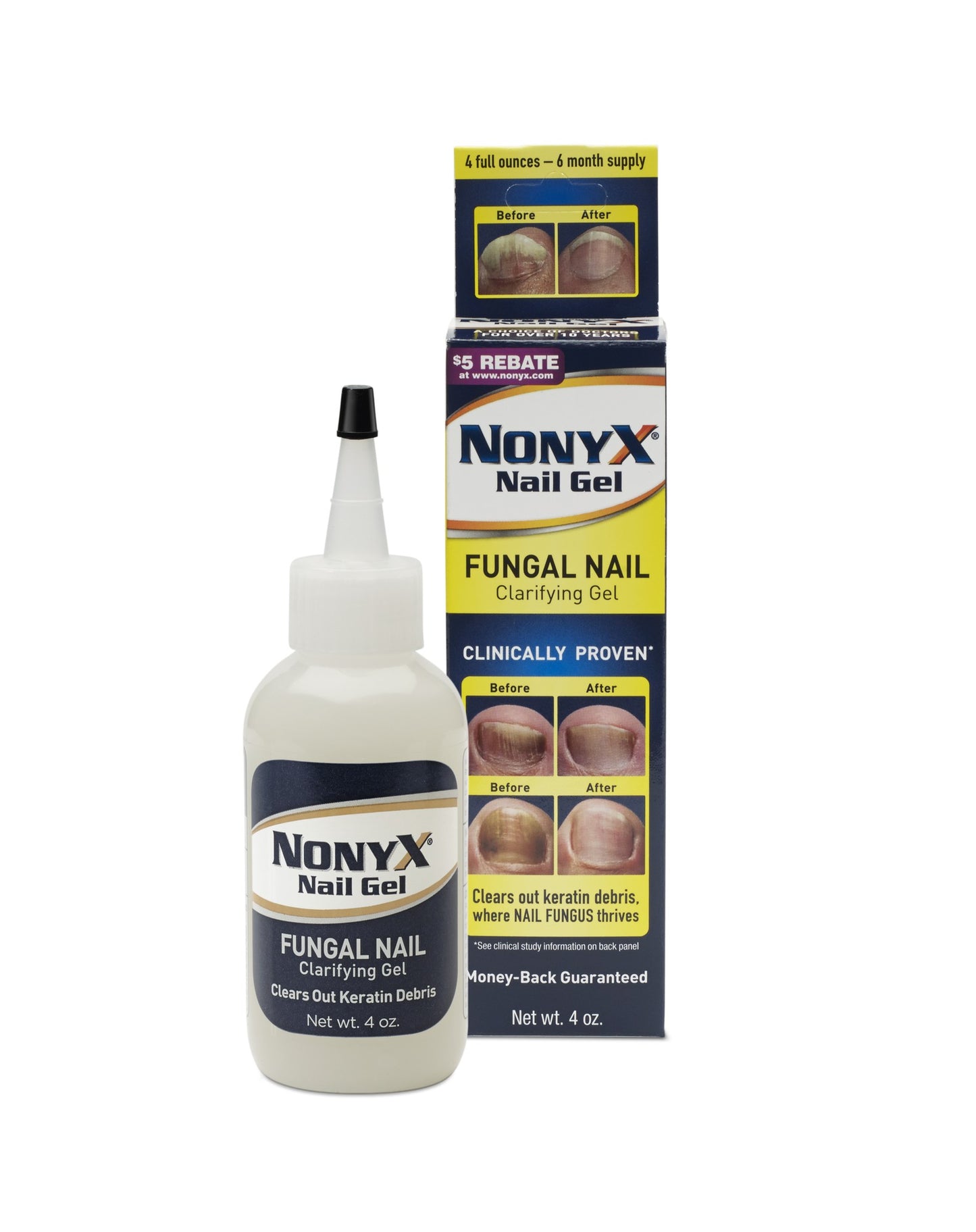 Nonyx Fungal Nail Clarifying Gel, 4 Oz